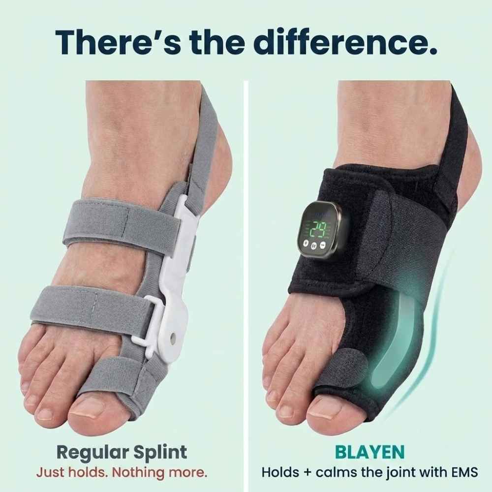 VELNORA™ | EMS Bunion Corrector