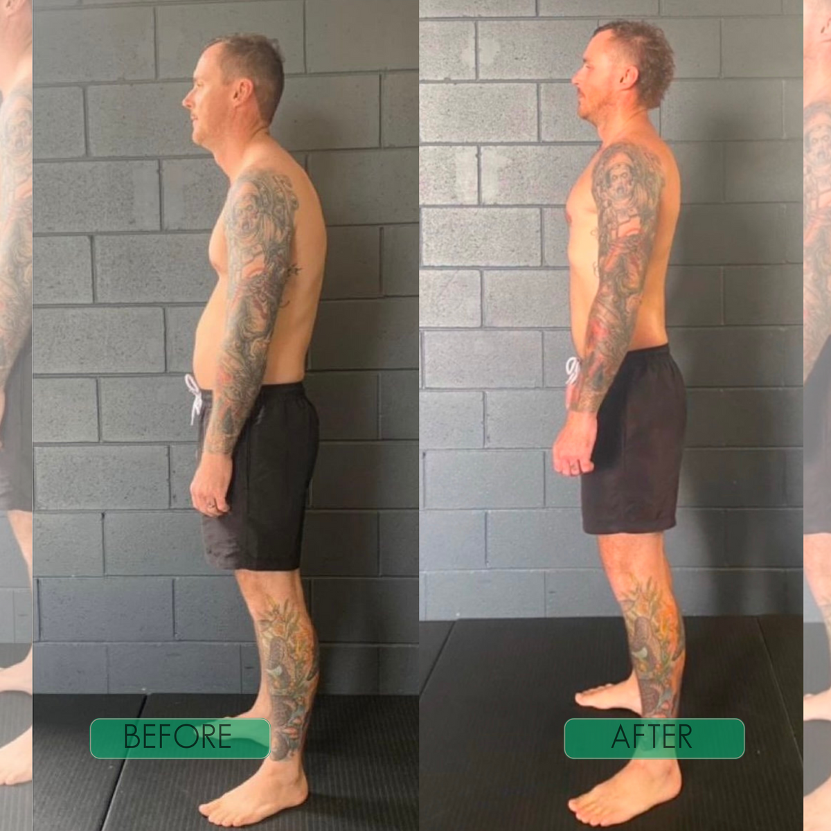 PostureAlign™ Adjustable Upper-Back Support Brace
