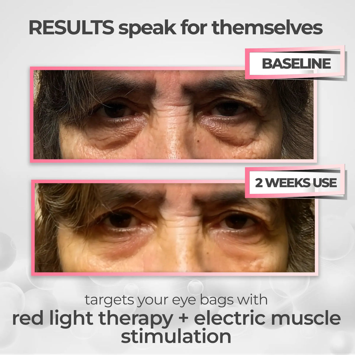 EyeLuma™ 2-in-1 Red Light Eye Therapy Device