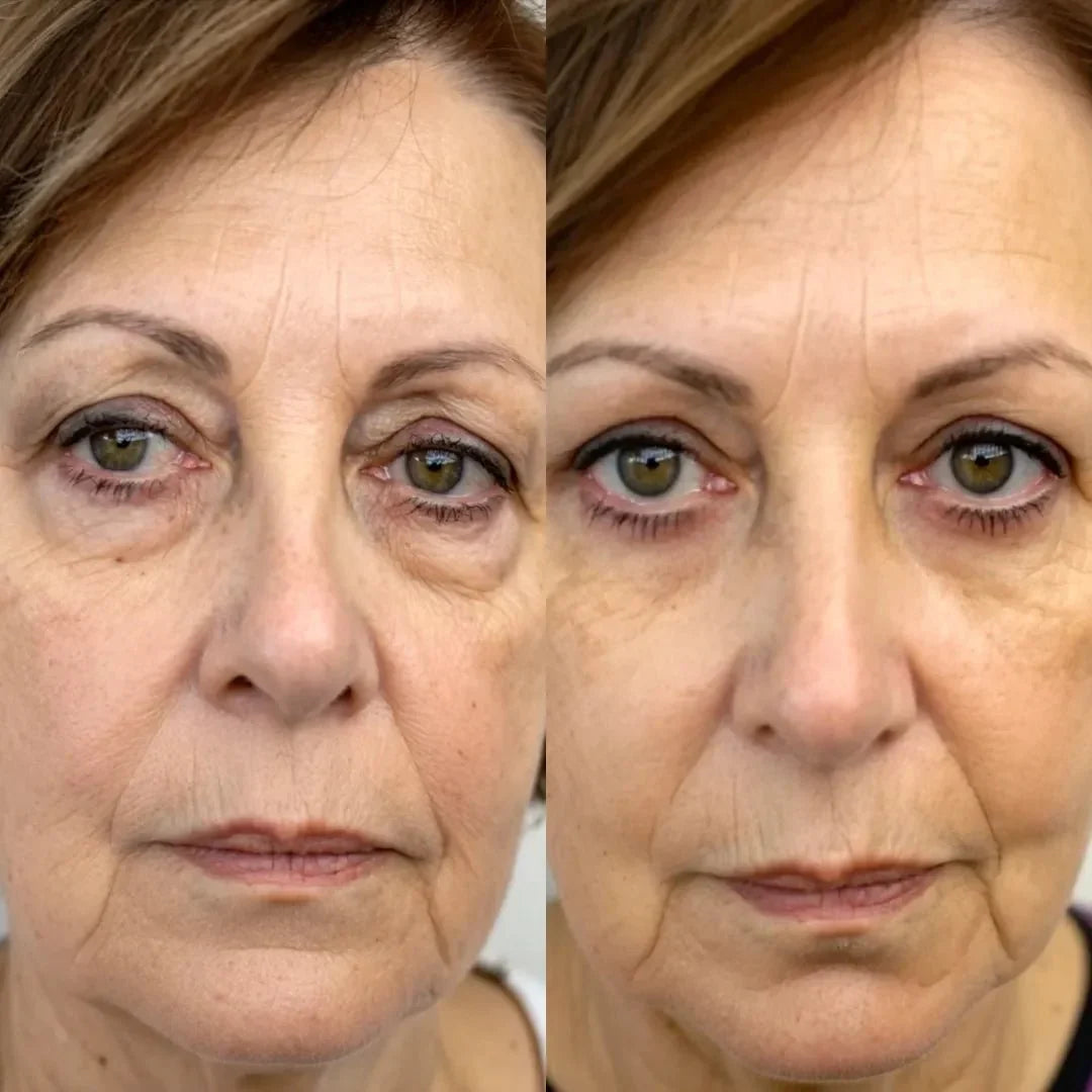 EyeLuma™ 2-in-1 Red Light Eye Therapy Device