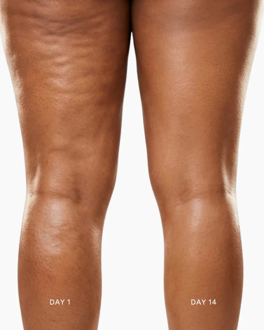 SculptGlow™ Body Sculpting Massage Device