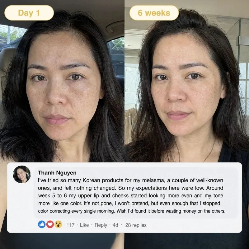 KojicGlow™ Turmeric & Kojic Acid Overnight Mask