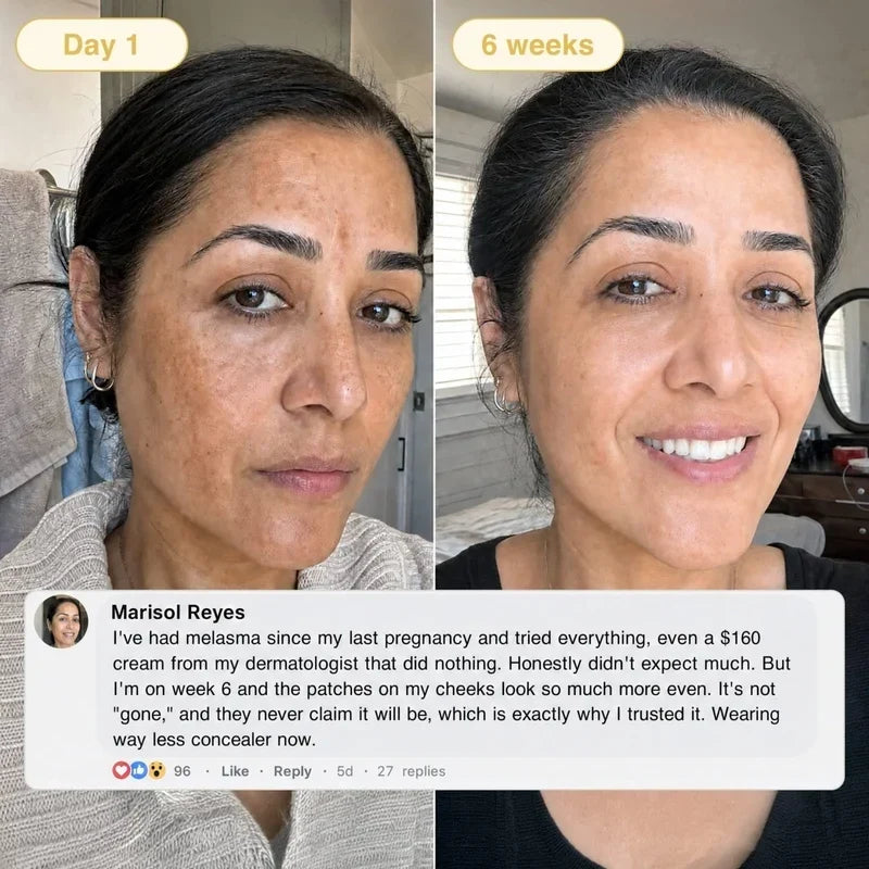 KojicGlow™ Turmeric & Kojic Acid Overnight Mask